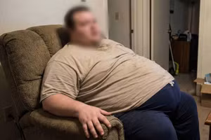 Béo phì nhưng cơ thể suy kiệt, lười vận động. 