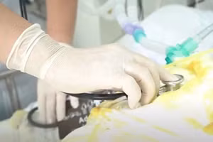 Người mẹ được điều trị tại Bệnh viện Chợ Rẫy, tiên lượng rất nặng. (Ảnh: BVCC)