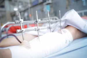 Nếu diễn tiến ổn, bệnh nhân có thể xuất viện sau 1 tuần. (Ảnh: BVCC)