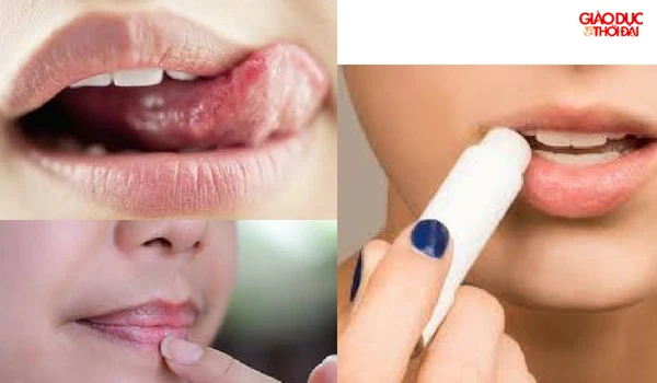 6 điều “quen tay” của các bạn gái tối kỵ với nhan sắc