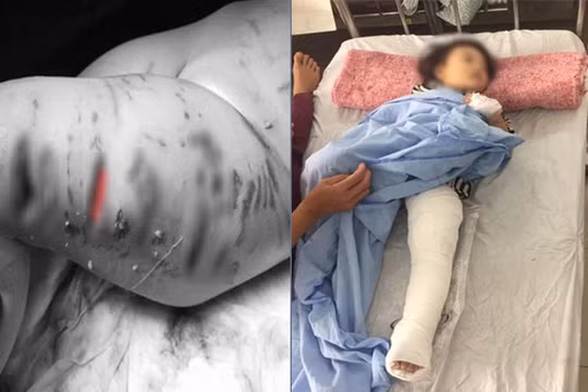 Chủ “ngồi bóc lịch” lên đến 10 năm nếu để chó cắn người ảnh 2