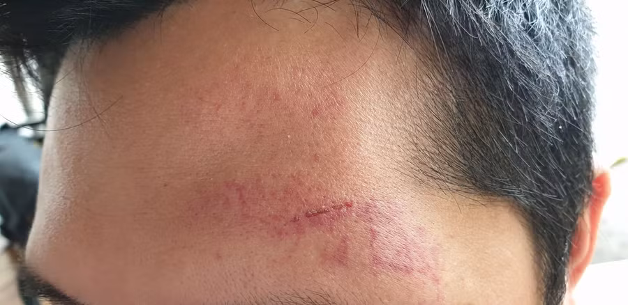 Phóng viên Tạp chí Thương trường bất ngờ bị nhóm người lạ mặt đánh tại Hà Nội