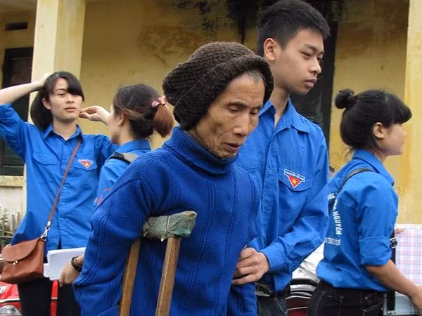 Các bạn sinh viên giúp đỡ các bệnh nhân mắc bệnh phong