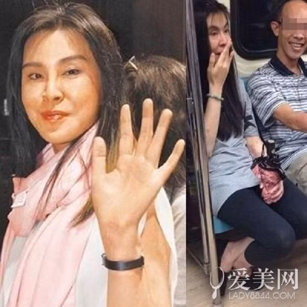 Vương Tổ Hiền từng khiến khán giả phát hoảng vì gương mặt dao kéo.