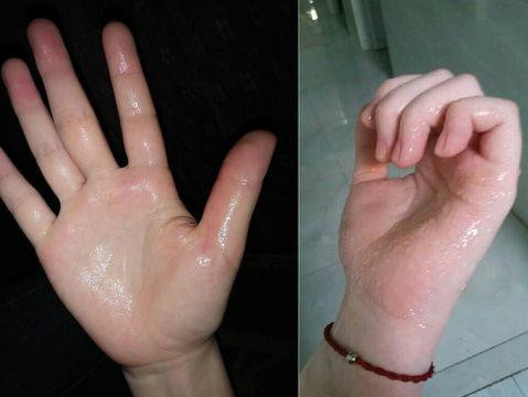 Những khu vực này đổ mồ hôi, cho thấy cơ thể đang gặp vấn đề ảnh 1 Những khu vực này đổ mồ hôi, cho thấy cơ thể đang gặp vấn đề ảnh 1
