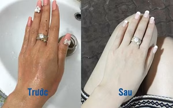 Có ngay 5 cách làm trắng da tay hiệu quả ngay tại nhà.
