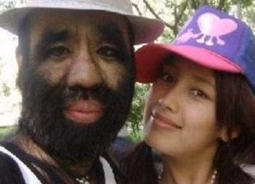 Cuộc sống sang chảnh hiện tại của cậu bé lông lá như người vượn từng gây sốc - 6