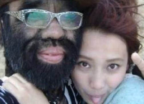 Cuộc sống sang chảnh hiện tại của cậu bé lông lá như người vượn từng gây sốc - 7