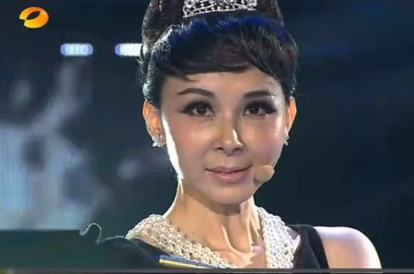 Gương mặt méo mó biến dạng khiến cô được ví là "thảm họa thẩm mỹ".