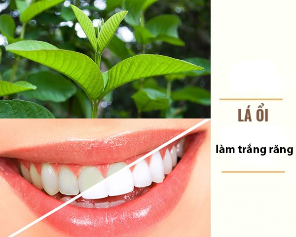 22 Cách làm trắng răng tự nhiên tại nhà hiệu quả nhanh nhất - 9