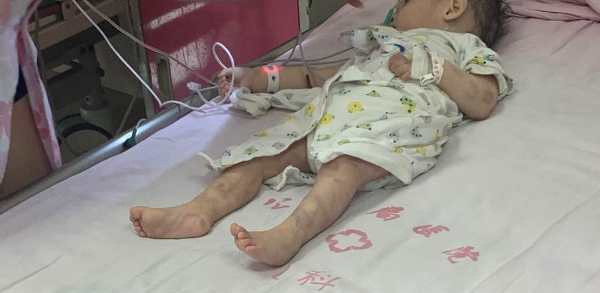 Hiện bé đã qua cơn nguy kịch và tiếp tục được điều trị Hiện bé đã qua cơn nguy kịch và tiếp tục được điều trị