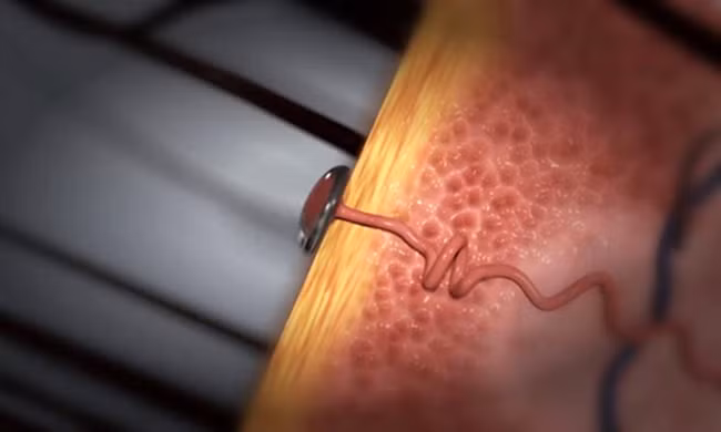 Cơ chế đổ mồ hôi của cơ thể