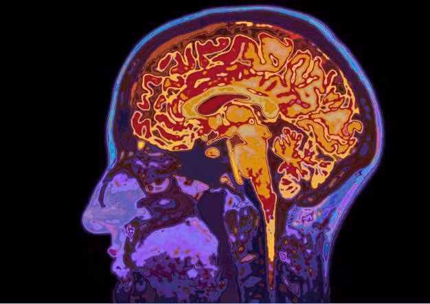 Bay vào vũ trụ làm thay đổi cấu trúc não bộ