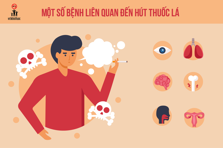 Một số bệnh liên quan đến hút thuốc lá. Một số bệnh liên quan đến hút thuốc lá.