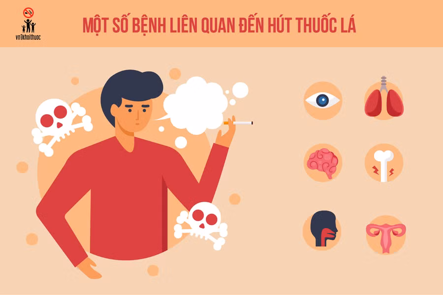 Một số bệnh liên quan đến hút thuốc lá.