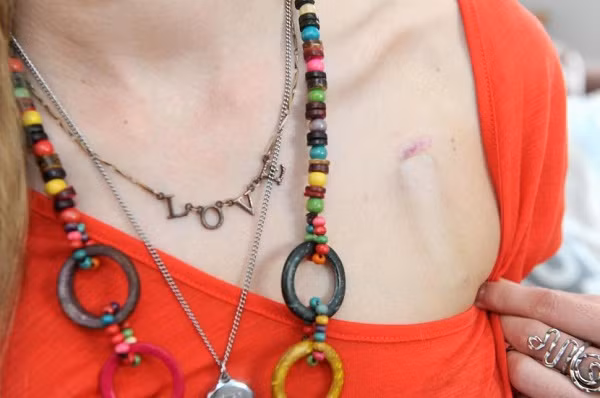 Chứng bệnh lạ khiến cô gái trẻ 