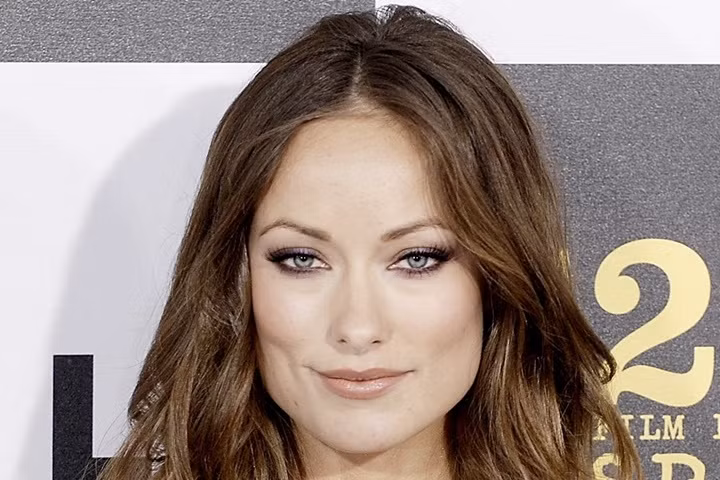 Tại sao một số người có hai màu mắt khác nhau? ảnh 5