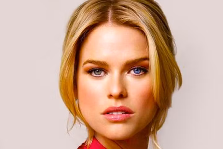 Tại sao một số người có hai màu mắt khác nhau? ảnh 2