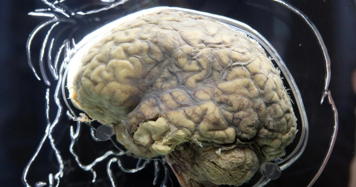 Con người c&oacute; thể suy nghĩ được sau khi chết? | B&aacute;o Gi&aacute;o dục v&agrave; Thời đại  Online