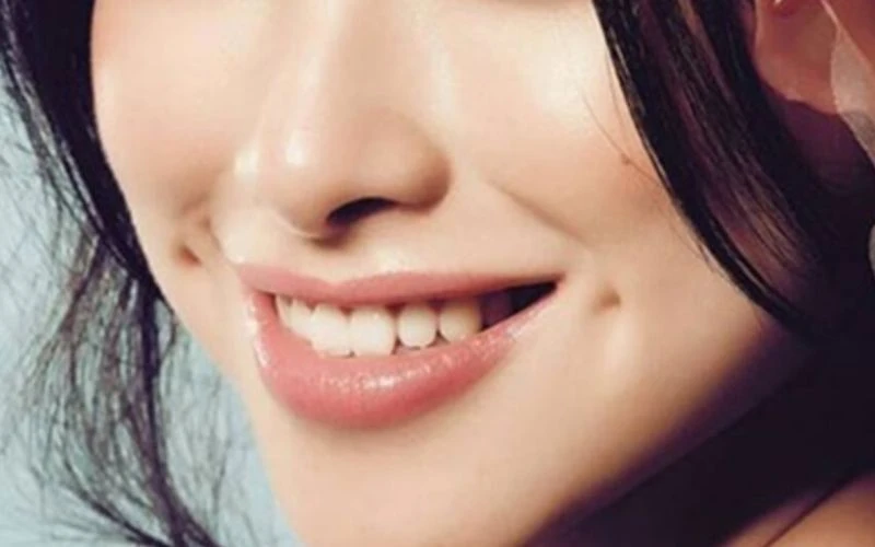 NAM GIỚI SỞ HỮU MÁ LÚM ĐỒNG TIỀN DUYÊN DÁNG BÊN MÁ PHẢI