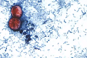 Hai nang bào tử Cyclospora cayetanensis.