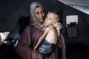 Cậu bé Muhammad đang vật lộn giành sự sống ở Gaza khi thảm họa nhân đạo ngày càng trầm trọng.