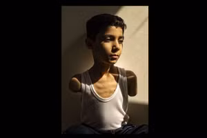 Bức chân dung cậu bé Palestine mất cả hai tay giành giải Ảnh báo chí của năm.