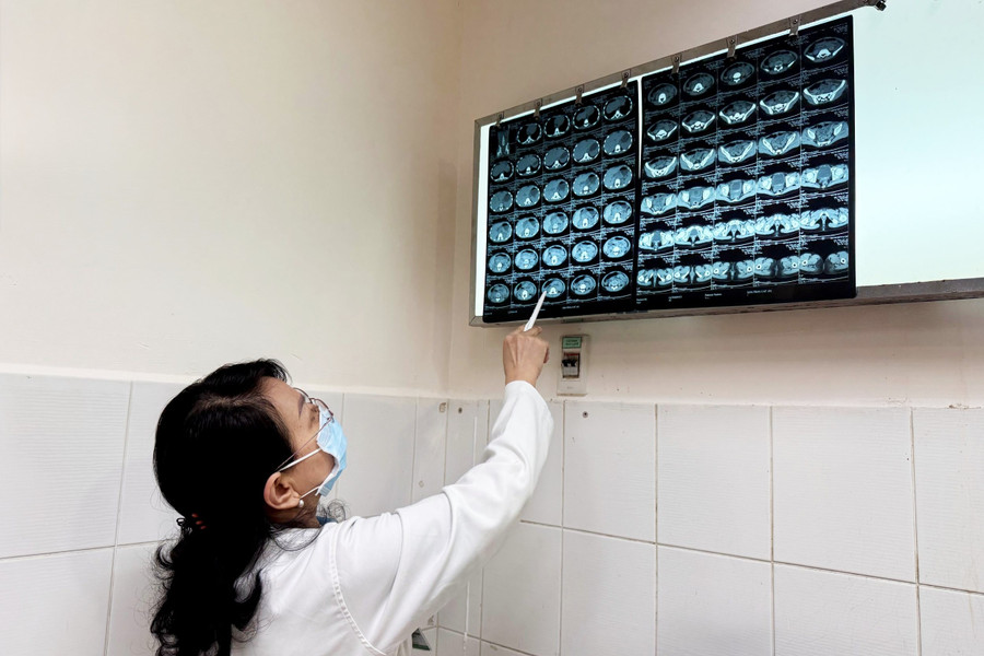 Bác sĩ đọc phim MSCT trước và sau điều trị của bệnh nhi. viem-tuy-cap.jpg