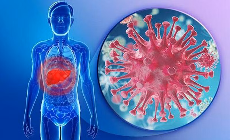 Viêm gan mãn tính do virus chiếm 60% nguyên nhân gây bệnh