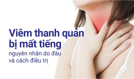 Viêm thanh quản bị mất tiếng khi tình trạng viêm diễn ra nặng