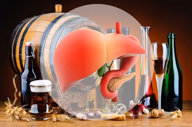 Kẻ thù của gan là bia rượu
