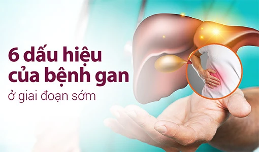 Dấu hiệu của bệnh gan không khó để nhận biết