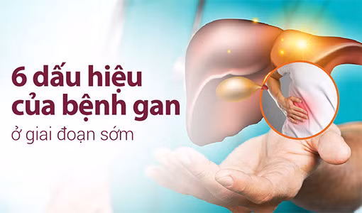 Dấu hiệu của bệnh gan không khó để nhận biết