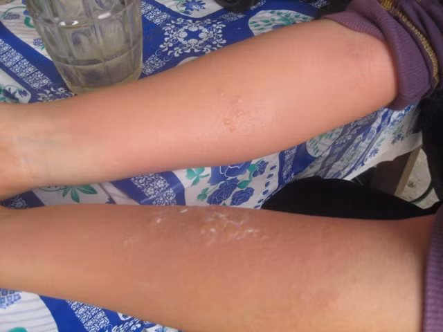 Báo động tình trạng sinh viên tự chẩn - chữa bệnh