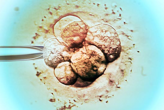 vô sinh, hiếm muộn, mang thai hộ, thụ tinh trong ống nghiệm, IVF vô sinh, hiếm muộn, mang thai hộ, thụ tinh trong ống nghiệm, IVF