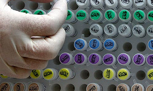 vô sinh, hiếm muộn, mang thai hộ, thụ tinh trong ống nghiệm, IVF vô sinh, hiếm muộn, mang thai hộ, thụ tinh trong ống nghiệm, IVF