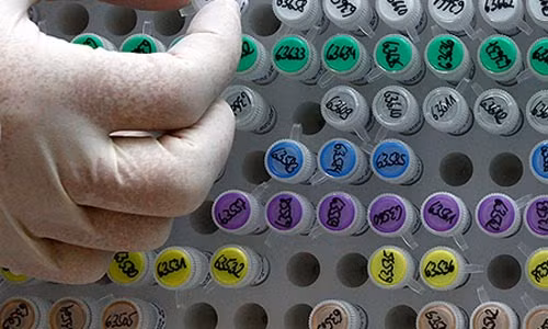 vô sinh, hiếm muộn, mang thai hộ, thụ tinh trong ống nghiệm, IVF vô sinh, hiếm muộn, mang thai hộ, thụ tinh trong ống nghiệm, IVF