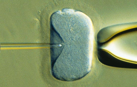 vô sinh, hiếm muộn, mang thai hộ, thụ tinh trong ống nghiệm, IVF vô sinh, hiếm muộn, mang thai hộ, thụ tinh trong ống nghiệm, IVF