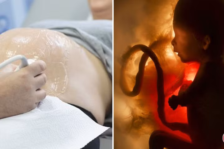 5 dấu hiệu báo thai nhi đang “kêu cứu” từ trong bụng mẹ