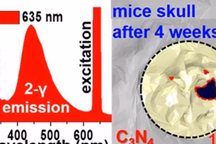Kỹ thuật tái tạo xương từ tế bào tủy và vật liệu cacbon