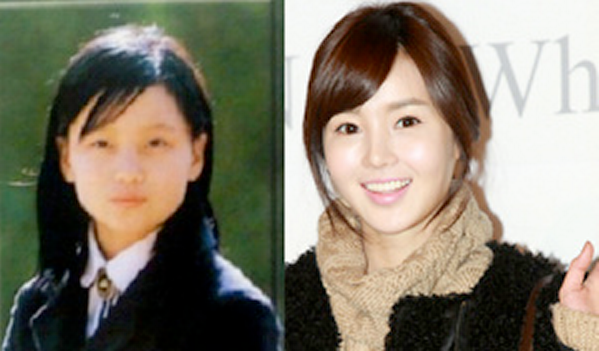 Mỹ nhân Hàn thời "vịt con xấu xí" ảnh 4 Nam Gyuri