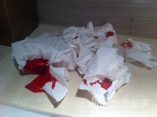 Đường Yên được bác sĩ băng bó