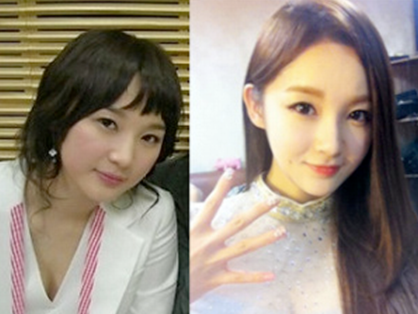 Mỹ nhân Hàn thời "vịt con xấu xí" ảnh 7 Davichi’s Kang Min Kyung