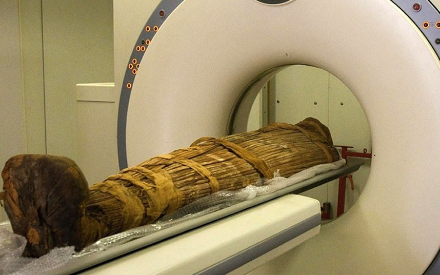The Mummy of Hatiay undergoes an MRI scan. A macabre study of mummified corpses shows that heart attacks and strokes may have plagued the ancient world as well as the modern one. Scientists studied 137 mummies from Egypt and other locations around the world dating back 4,000 years. More than a third showed signs of likely or definite hardening and narrowing of the arteries. The condition, known as atherosclerosis, is the primary cause of heart attacks and strokes caused by lack of blood to the brain. Until now it had been widely assumed that today’s high rates of heart and artery disease were chiefly the result of unhealthy modern lifestyles.