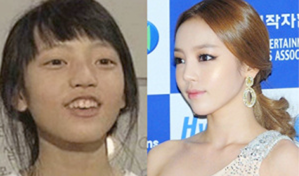 Mỹ nhân Hàn thời "vịt con xấu xí" ảnh 6 Kim Sarang