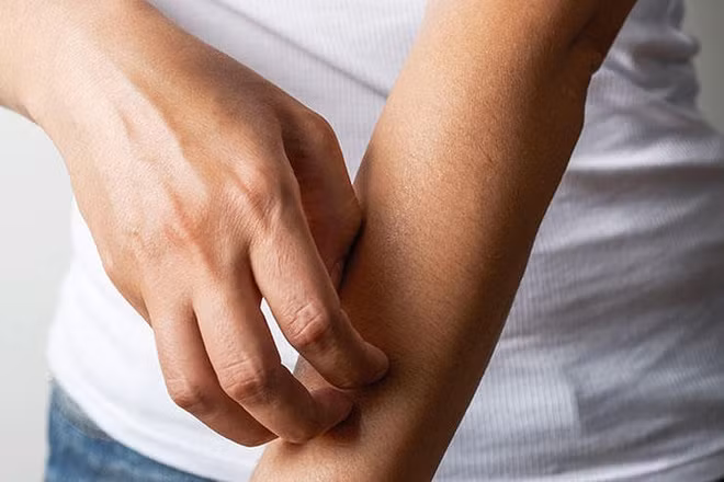 8 dấu hiệu không ngờ cảnh báo bạn bị stress