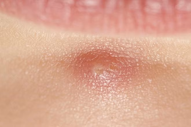 8 dấu hiệu không ngờ cảnh báo bạn bị stress