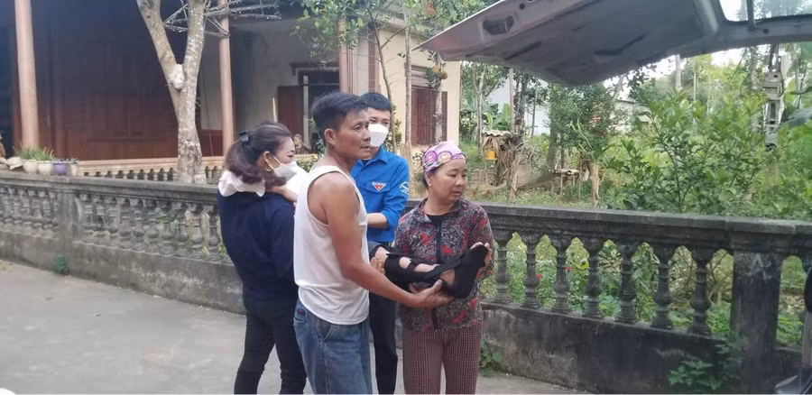 Em Đinh Hải Yến (HS lớp 9B, trường THCS Hương Lâm, huyện Hương Khê) không may bị tai nạn gãy chân trước ngày thi.