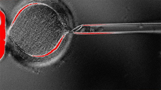 Kỹ thuật nhân bản tạo ra phôi thai người - (Ảnh: OHSU PHOTOS)