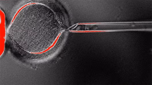 Kỹ thuật nhân bản tạo ra phôi thai người - (Ảnh: OHSU PHOTOS)